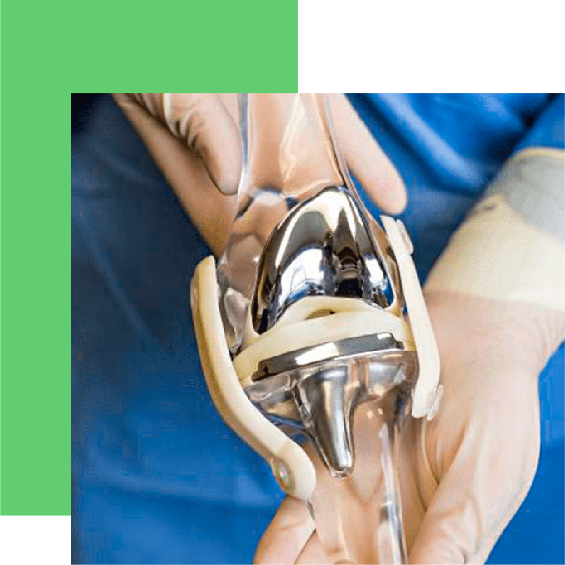 knee-replacement-surgery-expert-surgeries